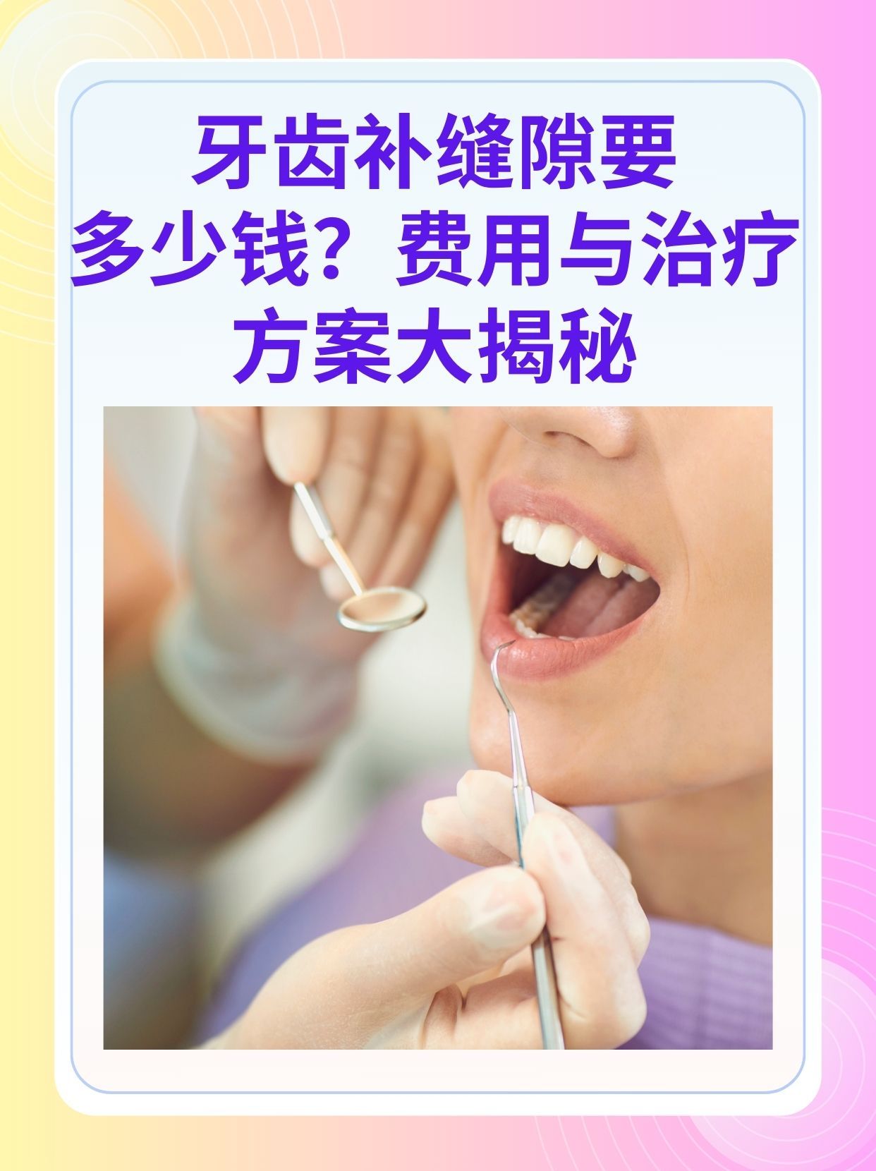 盐城补牙医保可以报销吗(补牙医保可以报销吗 哪些可以报销呢)